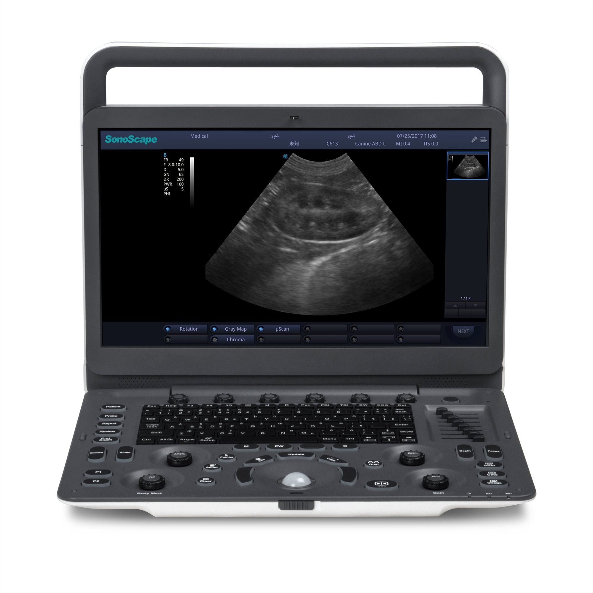 Medical Device