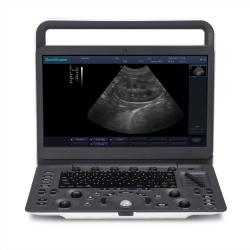 Sonoscape E1 Medical Ultrasound