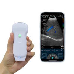 128 elements dual heads wireless ultrasound